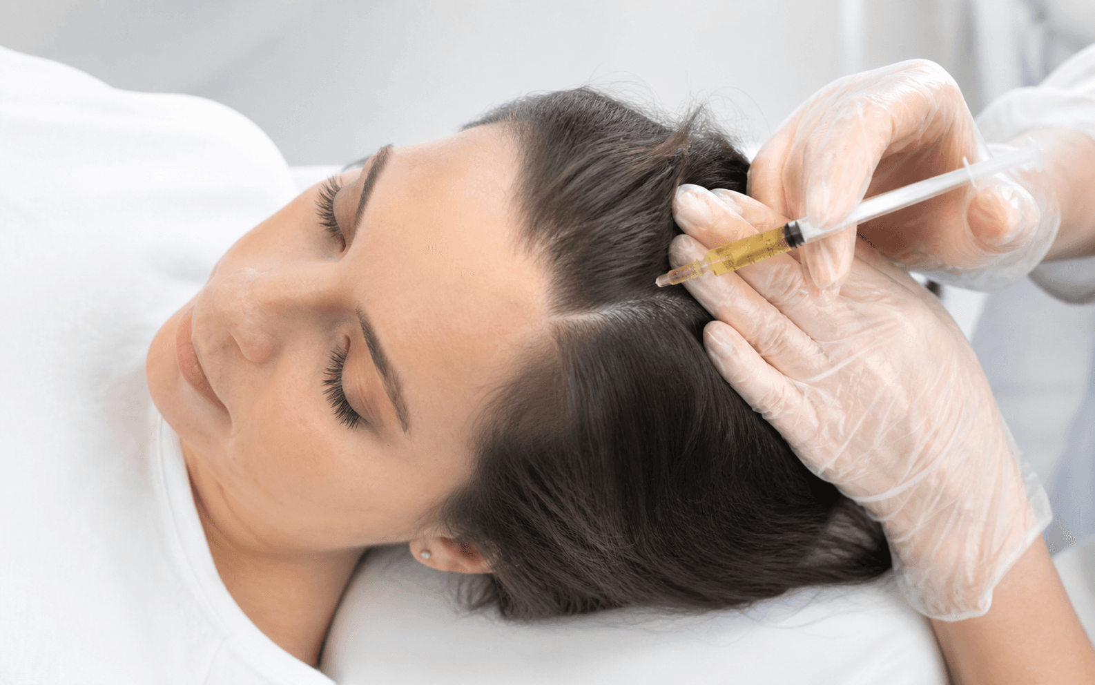 PRP & PRGF Hair Treatment — FKT Aesthetics